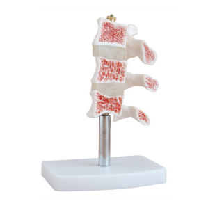 Spinal typical lesion model